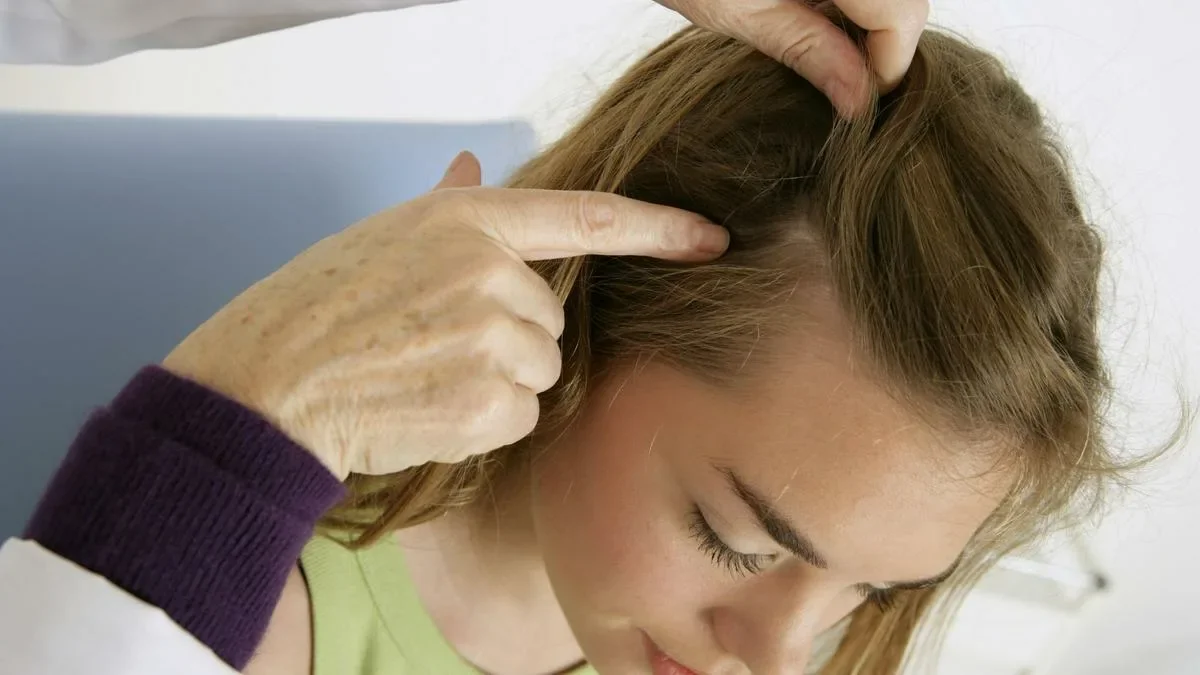 Перхоть или шелушение из-за сухости: как понять, что происходить с кожей головы