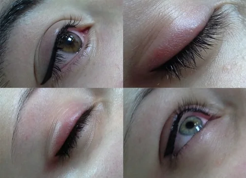 Татуаж век: уход после процедуры