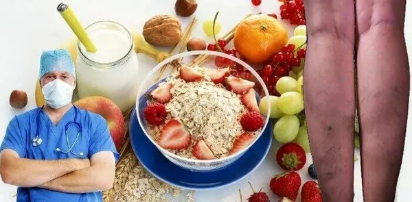 Правильное питание при варикозе: какие продукты поддерживают здоровье вен